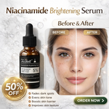 Teashell Niacinamide Brightening Serum |BUY ONE GET ONE FREE/ Fades Dark Spots, Evens Skin Tone & Boosts Glow (Buy 1 Get 1 Free)