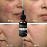 Teashell Niacinamide Brightening Serum |BUY ONE GET ONE FREE/ Fades Dark Spots, Evens Skin Tone & Boosts Glow (Buy 1 Get 1 Free)