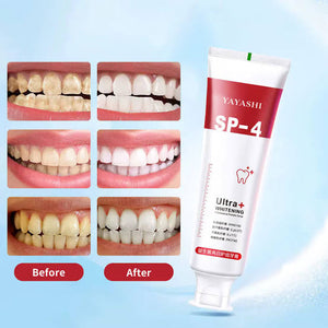 Yayashi SP4 Oral Care Probiotic Whitening Toothpaste 120g – Shine Brighter, Remove Years of Coffee, Tea & Smoking Stains (Buy 1 Get 1 free deal)