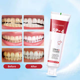 Yayashi SP4 Oral Care Probiotic Whitening Toothpaste 120g – Shine Brighter, Remove Years of Coffee, Tea & Smoking Stains (Buy 1 Get 1 free deal)