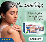 South Moon Lipoma Removal Cream Buy 1 Get 1 free