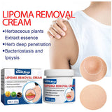 South Moon Lipoma Removal Cream Buy 1 Get 1 free